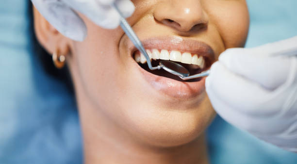 Best Chipped Tooth Repair Near Me  in Campbellsburg, KY