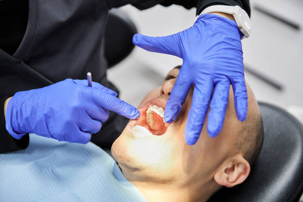 Emergency Dental Filling Replacement in KY